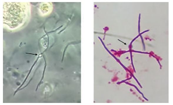 Bactérias (bacilos Gram-negativos) formando filamentos e esferoplastos. Microscopia de contraste de fase (A) e coloração de Gram (B)* 