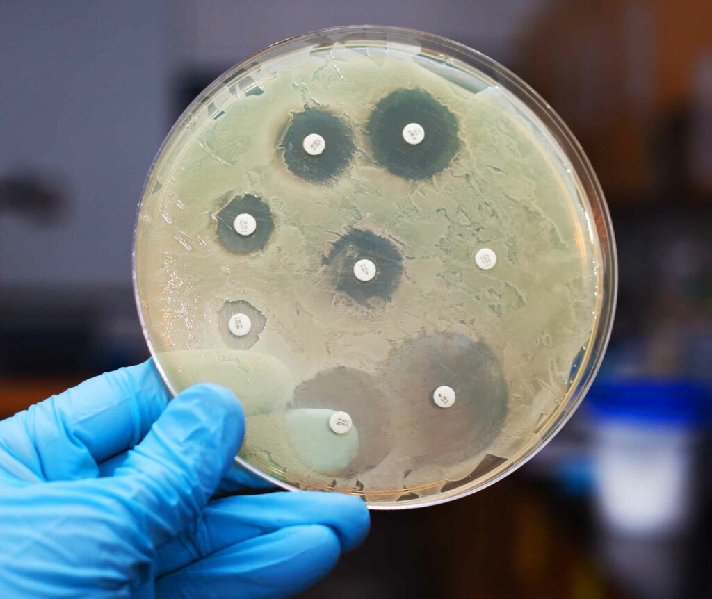 Superbactérias: a importância dos testes de sensibilidade