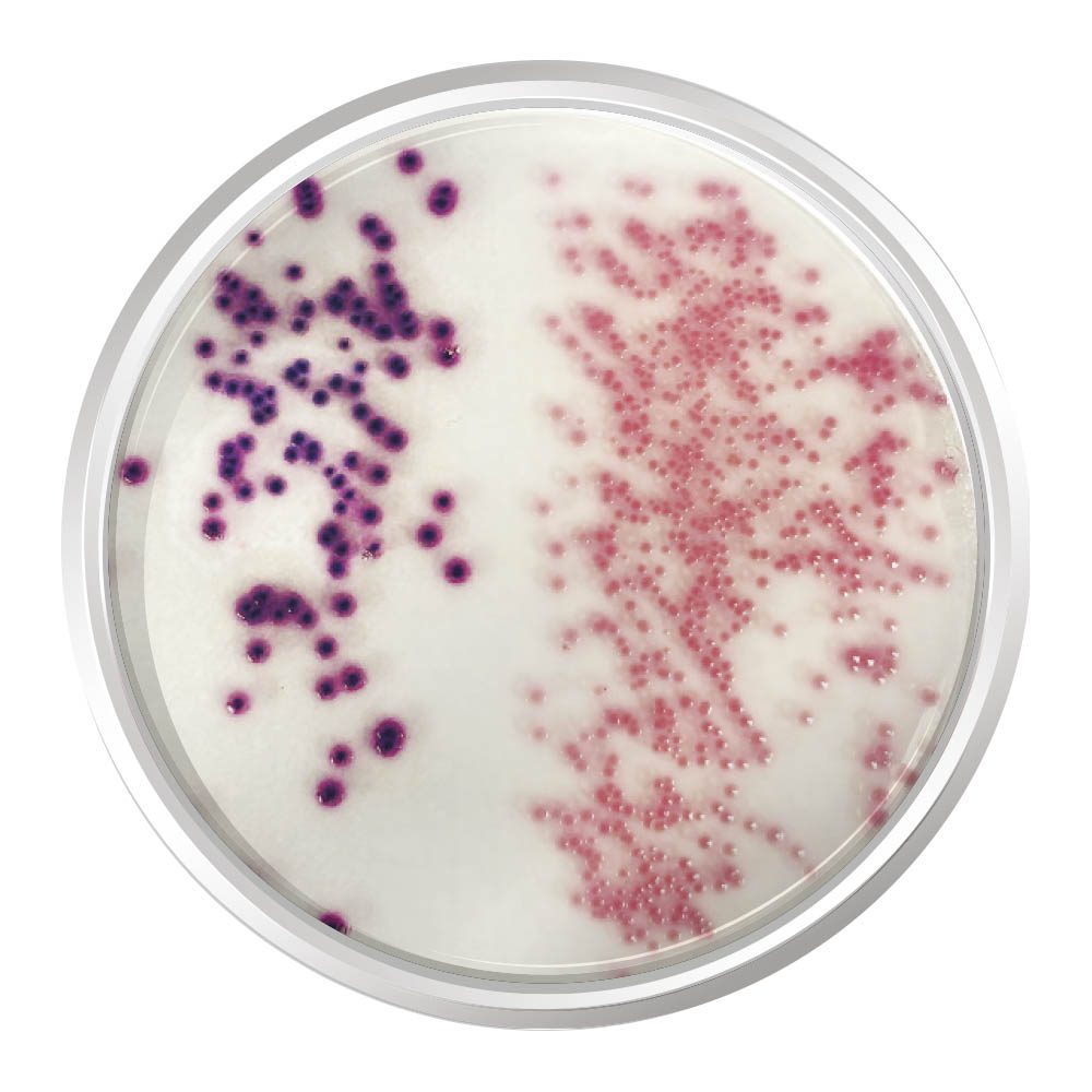 Agar Cromogênico E. coli coliformes (CCA)