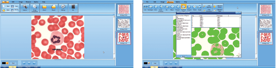 Contagem de células automática no software do Microscópio Trinocular