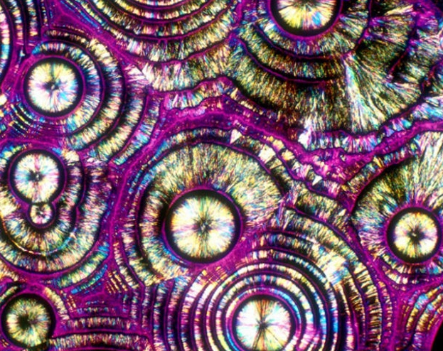 microscopia de polarização