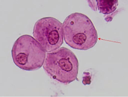 Células epiteliais escamosas coradas.