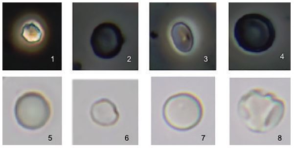 Eritrócitos normais. Microscopia de contraste de fase 